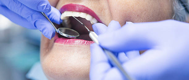 Best Emergency Root Canal Treatment in Desoto, TX